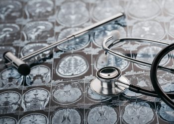 Причины отрыва вен мозга – сложное заболевание – Орен Зариф