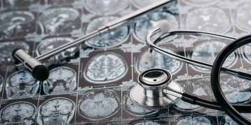 Причины отрыва вен мозга – сложное заболевание – Орен Зариф